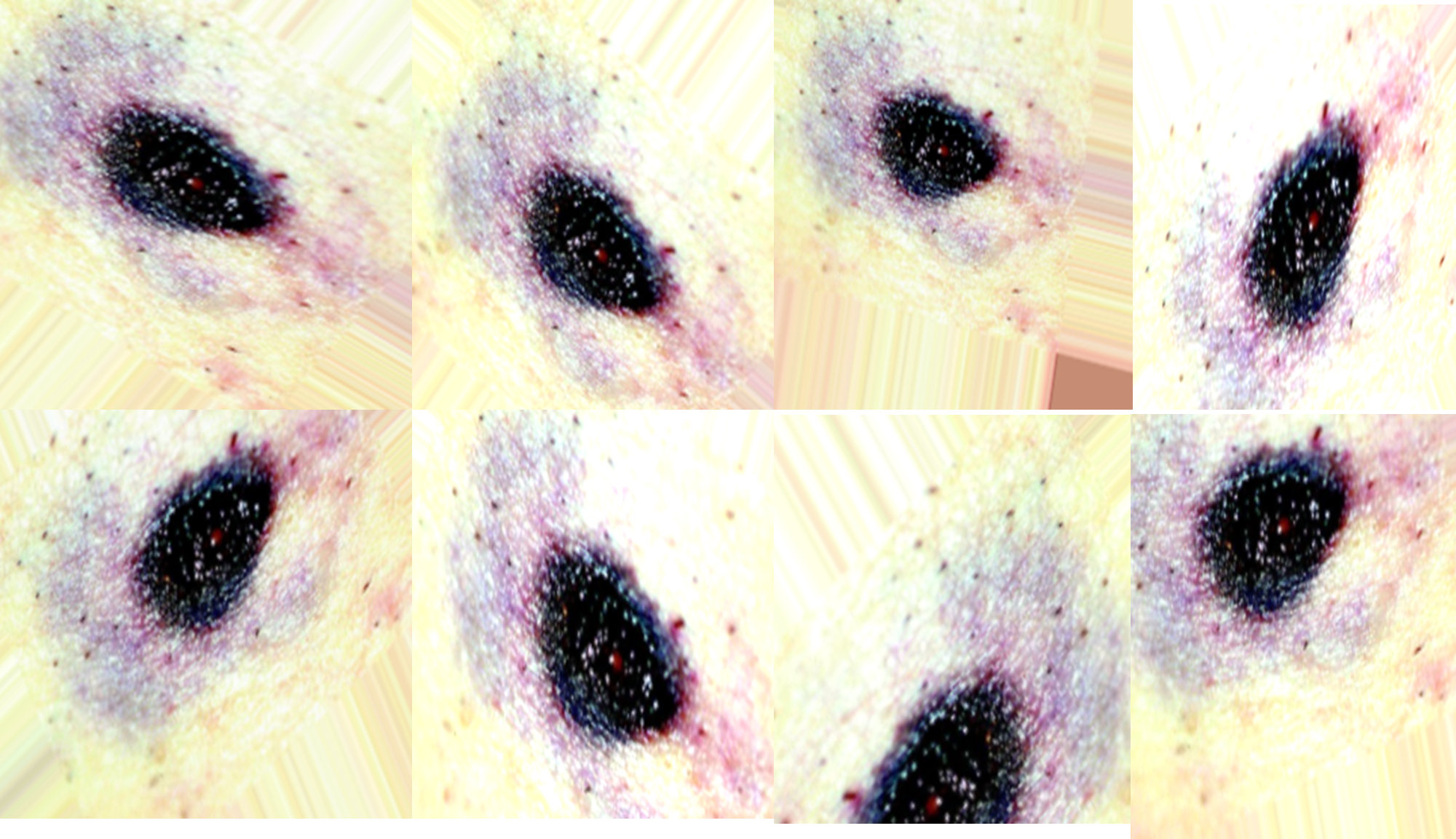Fig (4) Augmented gunshot wound images
